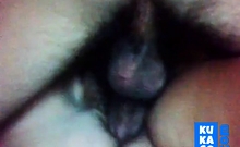 Hairy Mature Girl! Amateur!